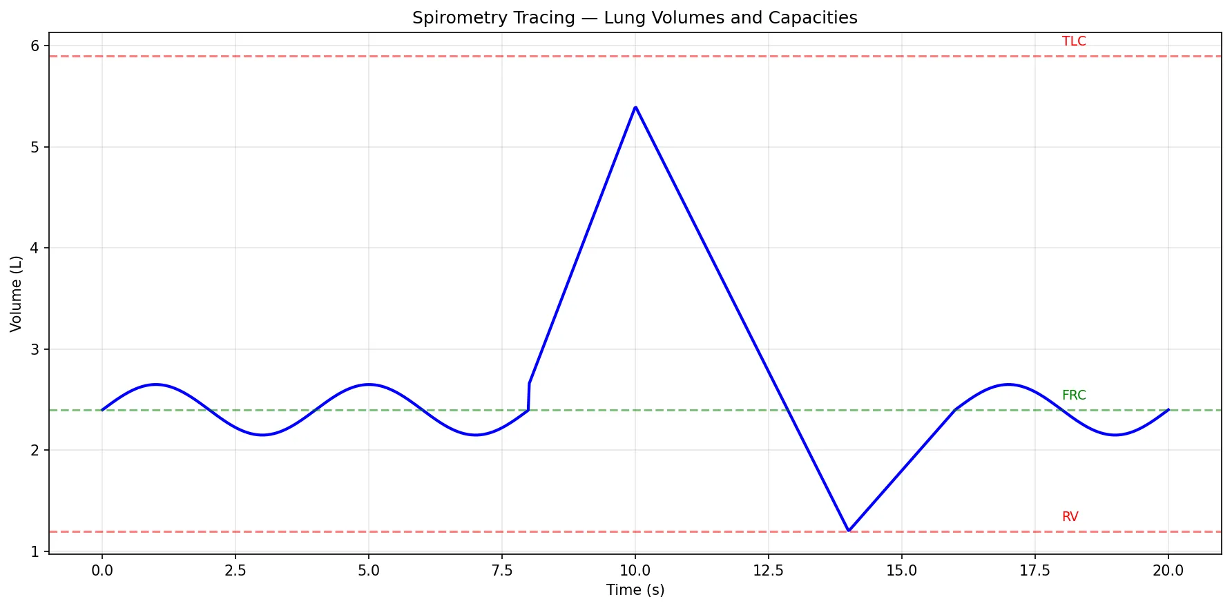Spirometry Tracing — Lung Volumes and Capacities